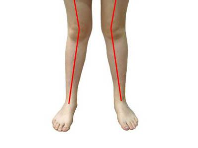 1510042073326396.jpg 1-150319141630917.jpg