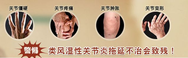 1510717020643239.jpg 风湿关节1.jpg