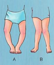 u=2067113903,1565927933&fm=21&gp=0 u=2067113903,1565927933&fm=21&gp=0