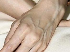 得了风湿病能喝酒吗 得了风湿病能喝酒吗