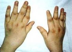 u=1456879112,1324107026&fm=21&gp=0 u=1456879112,1324107026&fm=21&gp=0