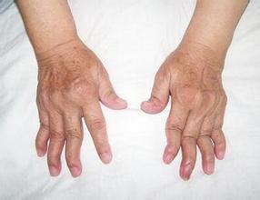 u=3781480129,899710272&fm=21&gp=0 u=3781480129,899710272&fm=21&gp=0