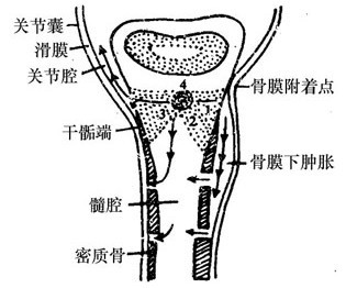 发病机理 发病机理