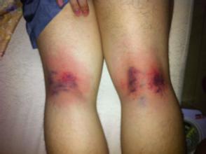 u=2952821300,3341545468&fm=21&gp=0 u=2952821300,3341545468&fm=21&gp=0