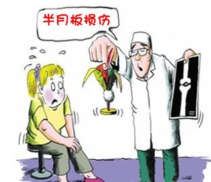 1511678459590137.jpg 半月板损伤15.jpg