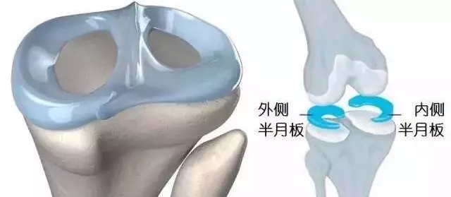 1511685861114288.jpg 半月板损伤19.jpg