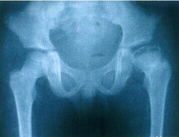 1511840037660150.jpg 3-140H2101Q6196.jpg