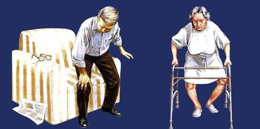 1511936868509367.jpg 骨性关节炎5.jpg