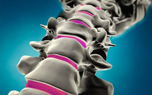 1512020889341242.jpg 膨出1.jpg