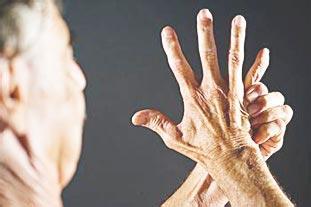 警惕类风湿性关节炎的危害 警惕类风湿性关节炎的危害