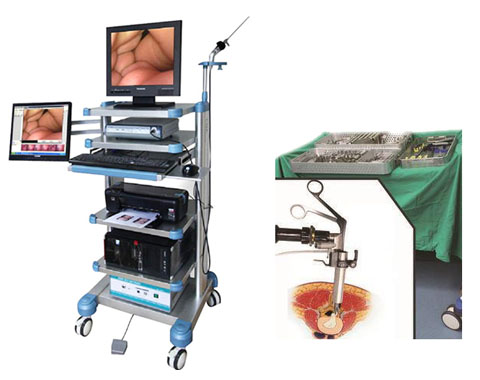 1515657149893339.jpg 德国JMTS椎间孔镜20.jpg