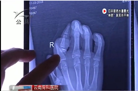 1522046082123251.jpg 云南骨科医院.jpg