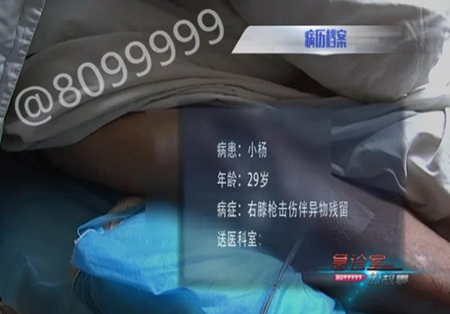 1536547026615999.jpg 病患 小杨.jpg