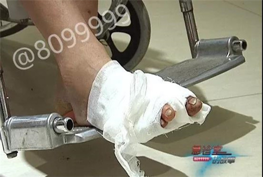 1538122962845316.jpg 周大姐的脚.jpg